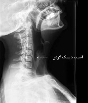 تشخیص