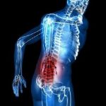 درد استخوان دنبالچه