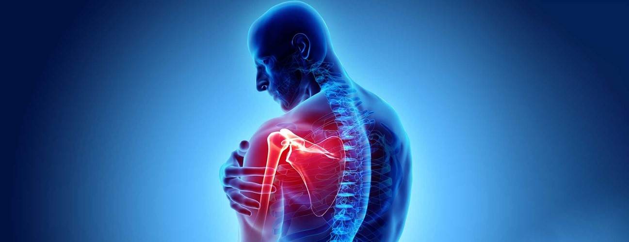 آرتروز شانه درمان خشکی و التهاب شانه بعلت آرتروز با فیزیوتراپی
