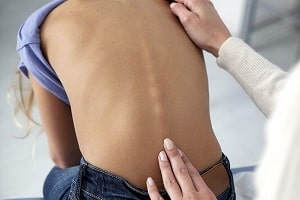 اسکولیوز (شاخص)