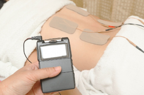 تحریک الکتریکی