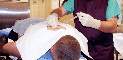 تزریق استروئید اپیدورال