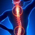 دیسک توراسیک چیست و چگونه درمان میشود؟ (فیزیوتراپی توراسیک)