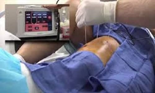 بلوک رادیوفرکوئنسی