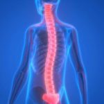 عفونت ستون فقرات کمر