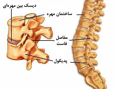 فتق دیسک کمر