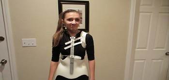 فواید بریس میلواکی کمر