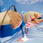 جراحی لیزری دیسک کمر