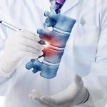 مراقبت های بعد از عمل لیزری دیسک کمر