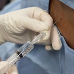 مزایا و مراحل تزریق اپیدورال برای درمان انواع درد کمر