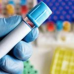 مزایای ارتوکین تراپی چیست؟ کاربردها و مراحل ارتوکین تراپی