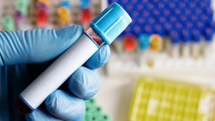 مزایای ارتوکین تراپی چیست؟ کاربردها و مراحل ارتوکین تراپی