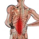 گودی و قوس زیاد کمر